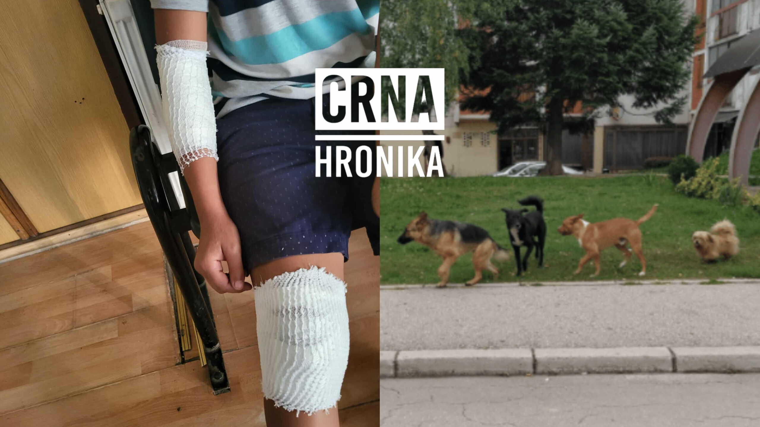 Pas lutalica napao desetogodišnjaka u Zavidovićima – Bosanski.info Pas lutalica napao desetogodišnjaka u Zavidovićima – Bosanski.info