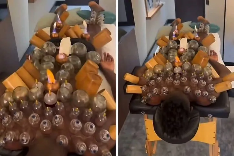 Andre Onana i hijama: Terapija za optimalan oporavak